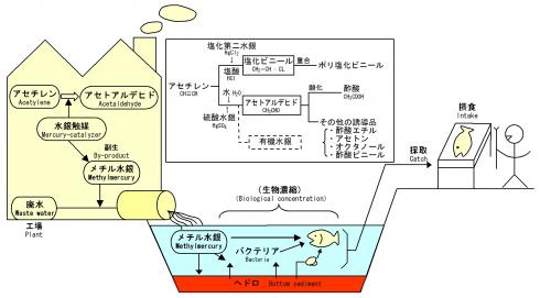 水俣 病 症状