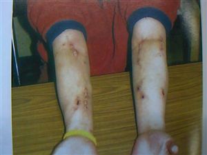 覚せい剤を使用するとの画像3